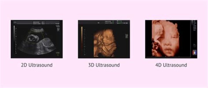 What Is the Difference Between 3D and HFR Formats?